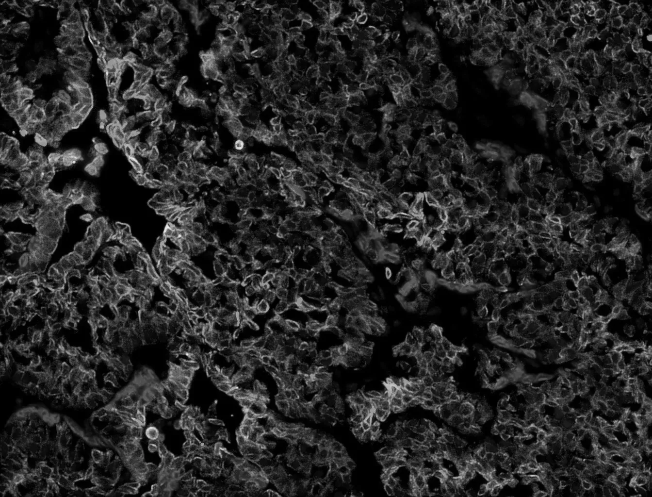 mikroskopibild i blått, grönt och rött mot en svart bakgrund